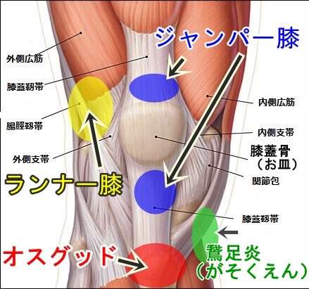 整形外科疾患シリーズ～膝蓋靱帯（ジャンパー膝）～【今日のお題　keiトレーナールーム】